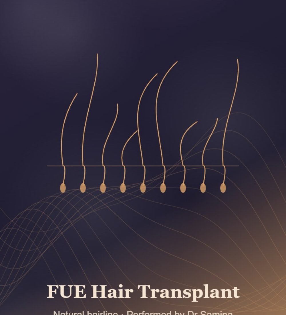FUE hair transplant by Dr Samina, Karachi